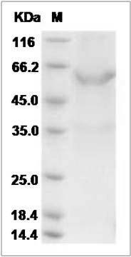 Mouse Meteorin / METRN Protein (Fc Tag) SDS-PAGE