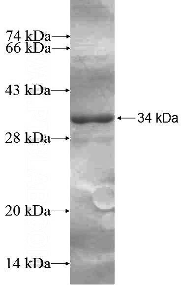 Recombinant Human CLDN16 SDS-PAGE