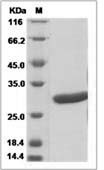 Rat Prolactin-8A9 / PLP-C beta / PRL8A9 Protein (His Tag)