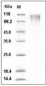 Human CD208 / LAMP3 / DC-LAMP Protein (His Tag) SDS-PAGE