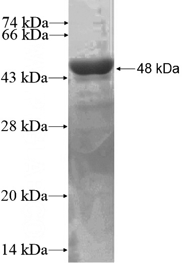 Recombinant Human TOMM40 SDS-PAGE