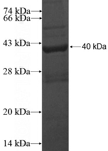 Recombinant Human SLC10A5 SDS-PAGE