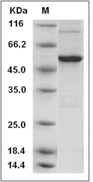 Mouse VDR / NR1I1 Protein (His Tag) SDS-PAGE