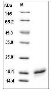 Human CD40L / CD154 / TNFSF5 Protein (His Tag) SDS-PAGE