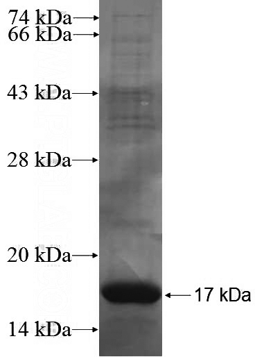 Recombinant Human PCSK6 SDS-PAGE