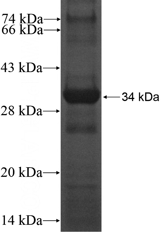 Recombinant Human SCRN3 SDS-PAGE