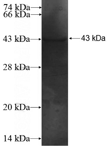 Recombinant Human PNKP SDS-PAGE