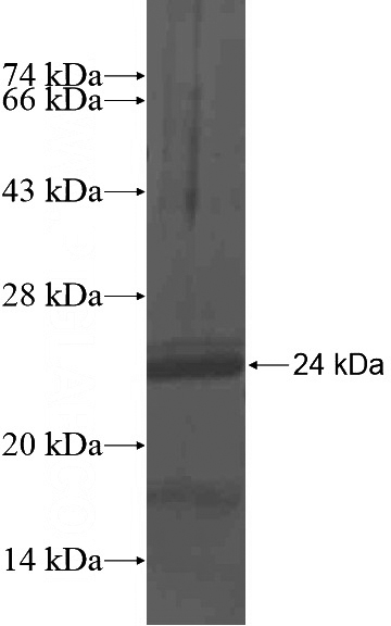 Recombinant Human BCL2L15 SDS-PAGE