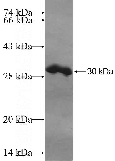 Recombinant Human CIP29 SDS-PAGE