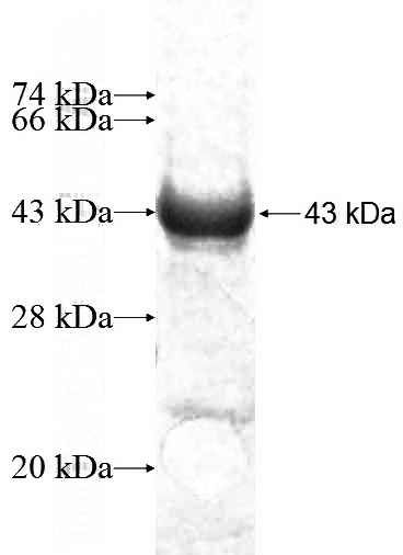 Recombinant Human MRPL38 SDS-PAGE