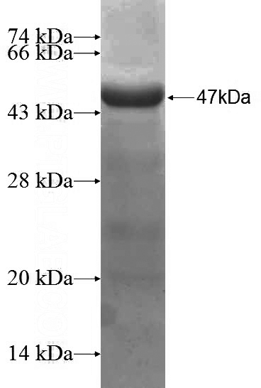 Recombinant Human L3MBTL3 SDS-PAGE