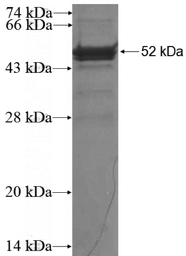 Recombinant Human RAP1GDS1 SDS-PAGE