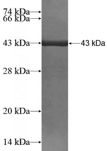Recombinant Human KCTD6 SDS-PAGE