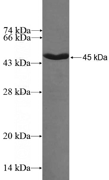 Recombinant Human JOSD1 SDS-PAGE