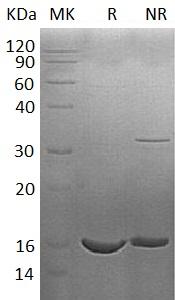 Human ISG15/G1P2/UCRP (His tag) recombinant protein