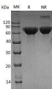 Human CNDP1/CN1/CPGL2/UNQ1915/PRO4380 (His tag) recombinant protein