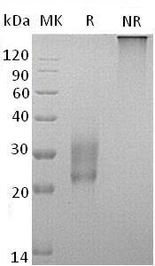 Human SPINT2/HAI2/KOP (His tag) recombinant protein