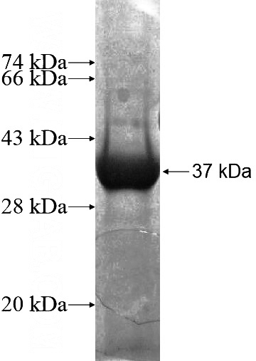 Recombinant Human ZNF397 SDS-PAGE