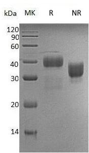 Human KLK5/SCTE/UNQ570/PRO1132 (His tag) recombinant protein