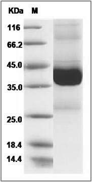 Human EIF-5A / EIF5 Protein (GST Tag) SDS-PAGE