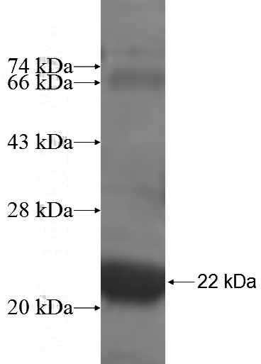 Recombinant Human NDUFB7 SDS-PAGE