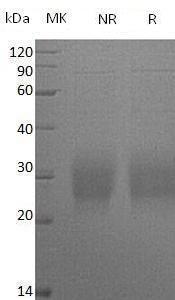 Mouse Cd74/Ii (His tag) recombinant protein