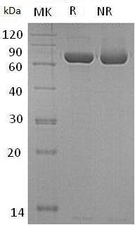 Human CPNE1/CPN1 (His tag) recombinant protein
