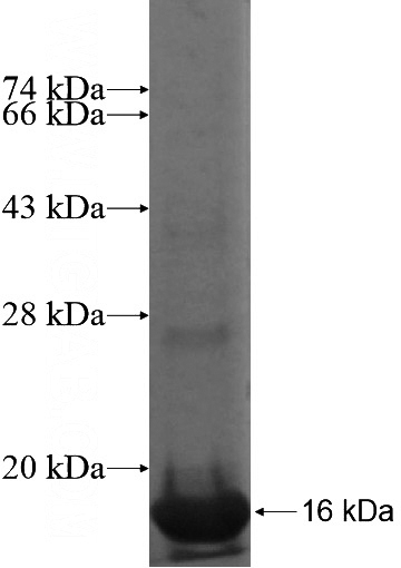 Recombinant Human RHBDD1 SDS-PAGE