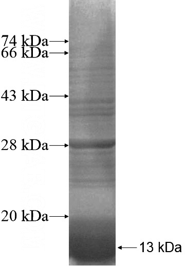 Recombinant Human LASS4 SDS-PAGE