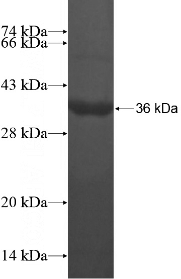 Recombinant Human LONRF2 SDS-PAGE