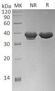Human ARG1 (His tag) recombinant protein