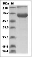 Human AMBP / Alpha 1 microglobulin Protein (Fc Tag) SDS-PAGE