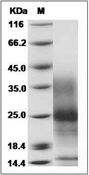 Human Vasoactive intestinal peptide / VIP Protein (His Tag) SDS-PAGE