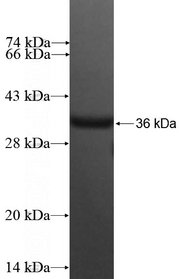 Recombinant Human COMMD6 SDS-PAGE