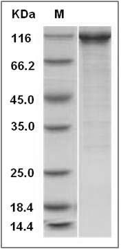 Mouse beta-Catenin / CTNNB1 Protein (His & GST Tag) SDS-PAGE