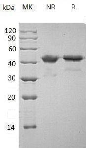 Human WIF1/UNQ191/PRO217 (His tag) recombinant protein
