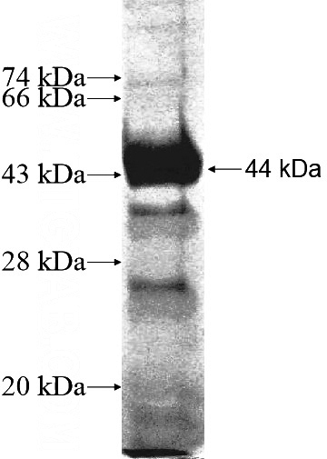 Recombinant Human UTP6 SDS-PAGE