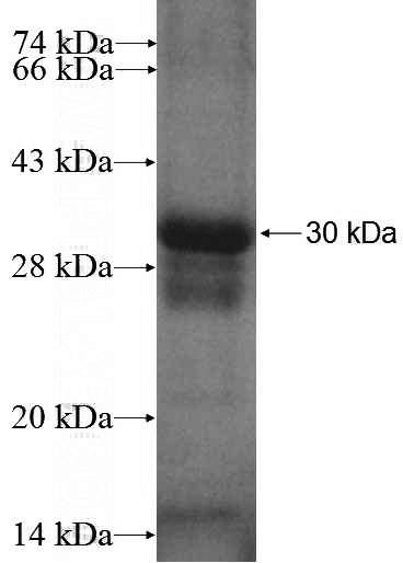 Recombinant Human ZBTB24 SDS-PAGE