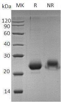 Human EGR1/KROX24/ZNF225 (His tag) recombinant protein