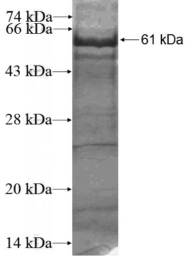 Recombinant Human MAGEB2 SDS-PAGE