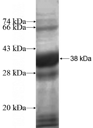 Recombinant Human METTL9 SDS-PAGE