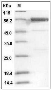 Human PTK6 / Brk Protein (GST Tag) SDS-PAGE