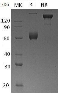 Human ESAM/UNQ220/PRO246 (Fc tag) recombinant protein