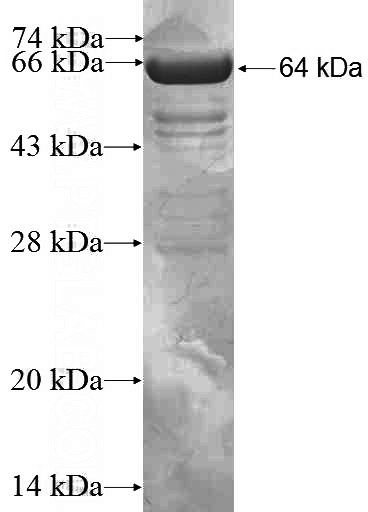 Recombinant Human STAU1 SDS-PAGE