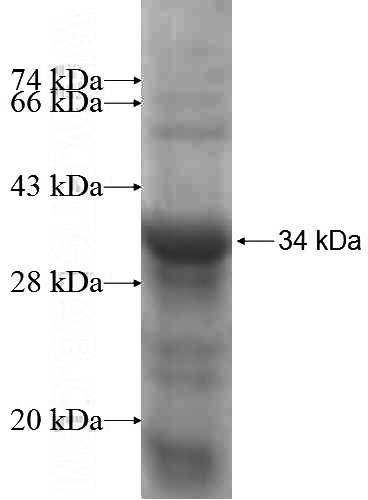 Recombinant Human GSC SDS-PAGE