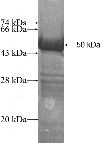 Recombinant Human NCOA4 SDS-PAGE