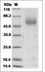 Human FGFR2 / CD332 Protein (beta(IIIc), His Tag)