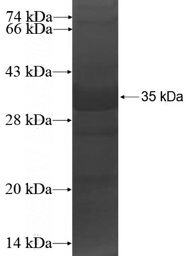 Recombinant Human ITIH4 SDS-PAGE
