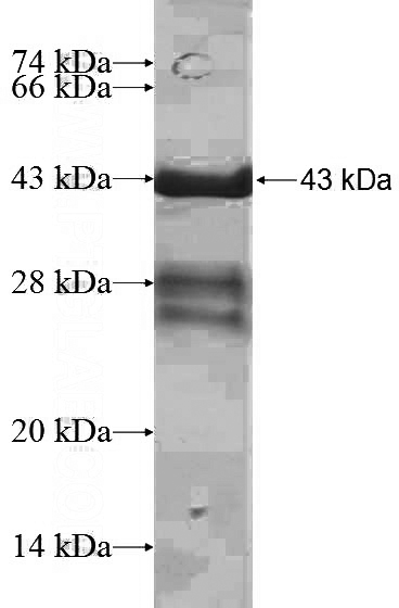 Recombinant Human SSH1 SDS-PAGE