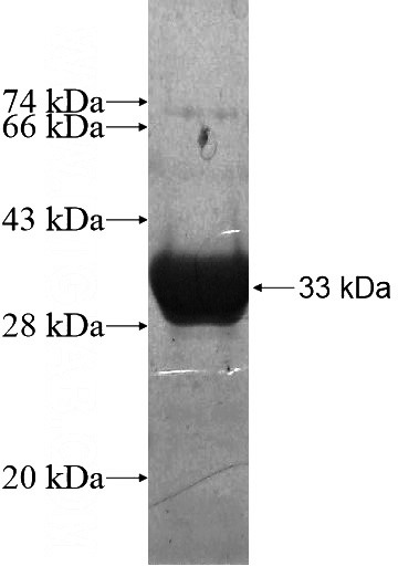Recombinant Human RBM7 SDS-PAGE